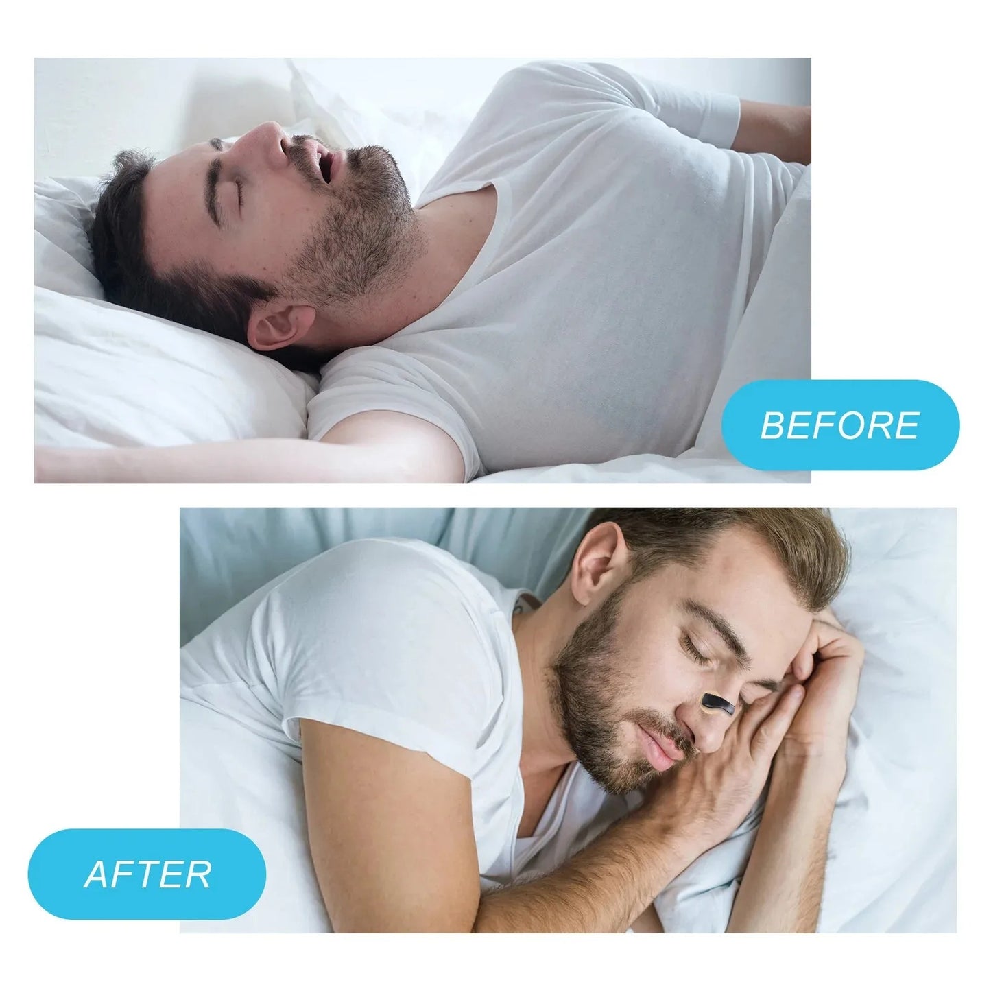 Magnetic Nasal Strips