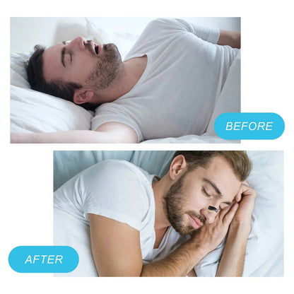 Magnetic Nasal Strips